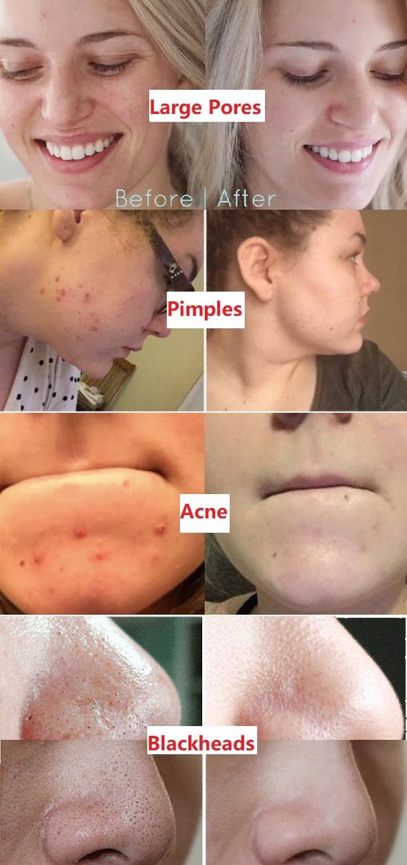 NATRAVOR®  Green Tea Deep Cleanse Mask Stick