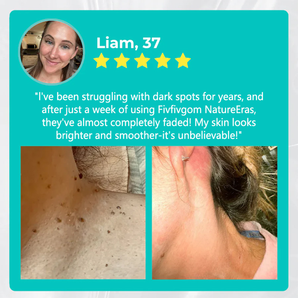 NATRAVOR® NatureErase Instant Mole & Spot Removal Gel