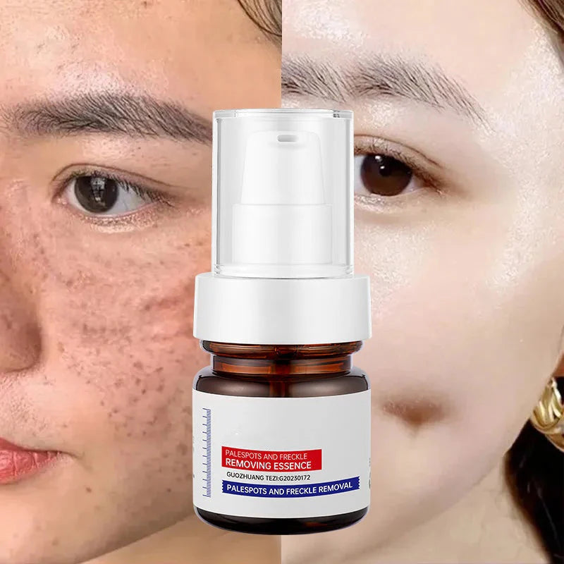 🏆【upgraded -40ML】Erase Dark Spots in 🔥8 Seconds – Kojic Acid & Vitamin C Brightening Serum for Instant Results