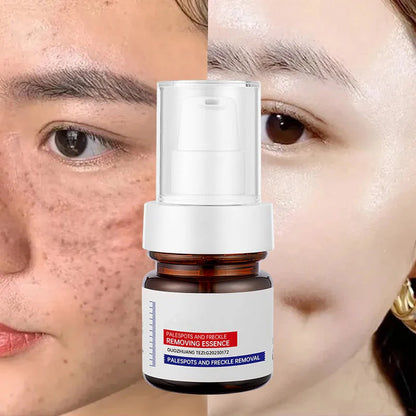🏆【upgraded -40ML】Erase Dark Spots in 🔥8 Seconds – Kojic Acid & Vitamin C Brightening Serum for Instant Results