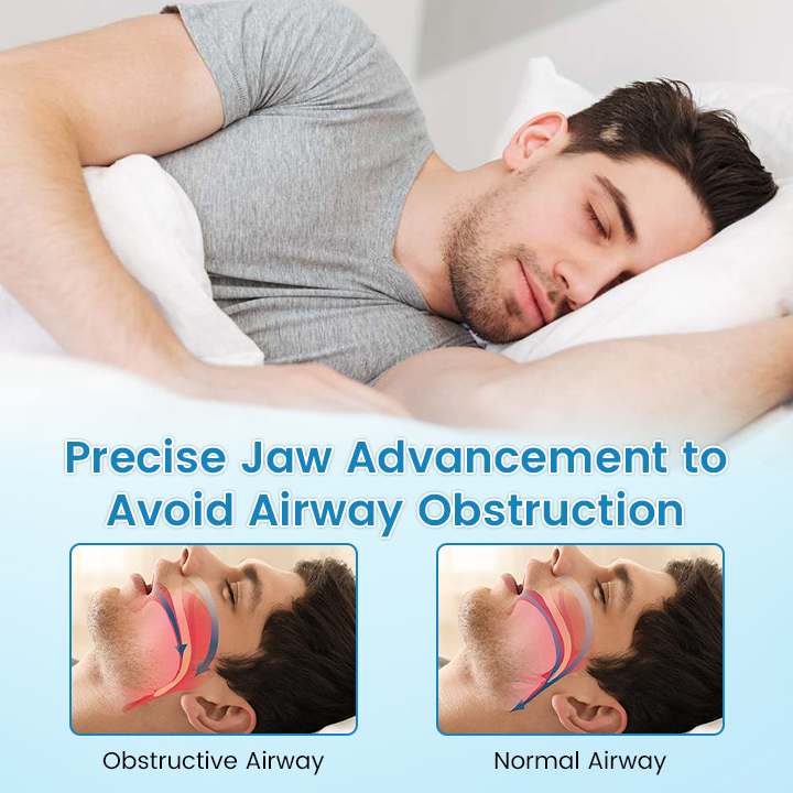 ✨NATRAVOR® DreamGuard: Anti-Snoring & Teeth Grinding Mouthpiece