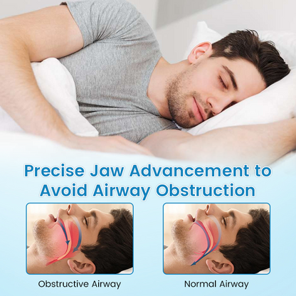 ✨NATRAVOR® DreamGuard: Anti-Snoring & Teeth Grinding Mouthpiece