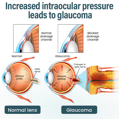 OptiFusion Nano Eye Drops Serum