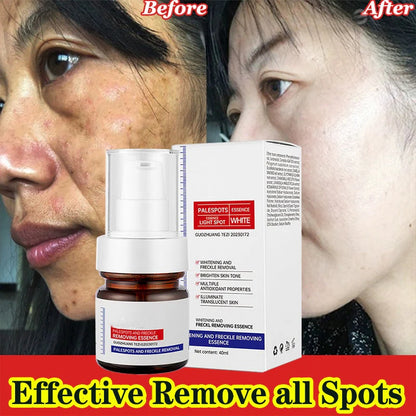 🏆【upgraded -40ML】Erase Dark Spots in 🔥8 Seconds – Kojic Acid & Vitamin C Brightening Serum for Instant Results