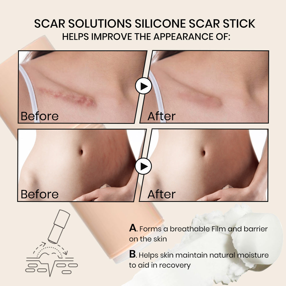 Silicone Scar Stick